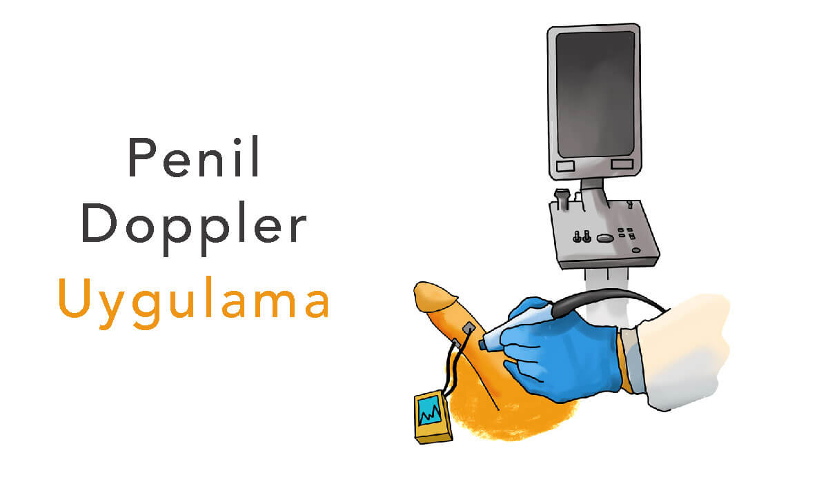 Penil Doppler Nasıl Yapılır?